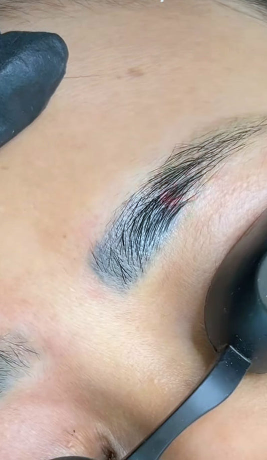 Tratamiento facial – eliminación de tatuajes