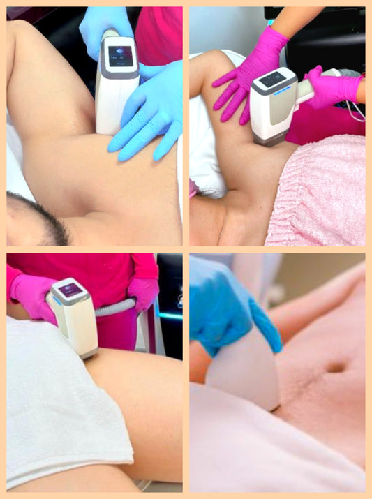 "COMBO GLOW UP" para hombre y mujer - Depilación láser en zonas de: Bikini brasilero + axilas