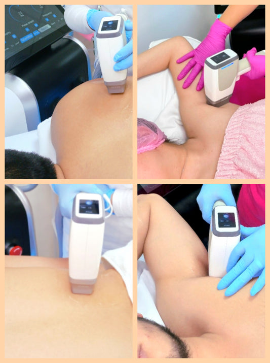 "COMBO GOLD" para hombre y mujer - Depilación láser en zonas de: Axilas + espalda completa