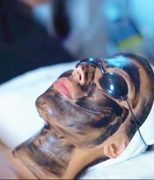 Tratamiento facial – hollywood peel