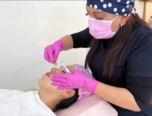 Tratamiento facial – Plasma rico en plaquetas (PRP) + ozono