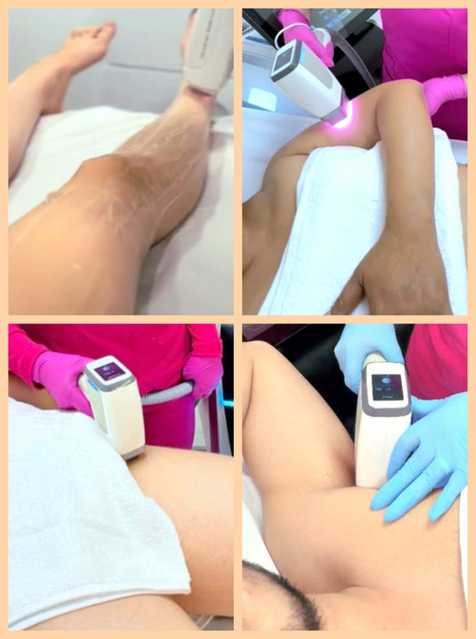 "COMBO SÚPER  ESTRELLA" para hombre y mujer -  Depilación láser en zonas de:   Piernas completas + brazos + axilas + bikini brasilero + pies