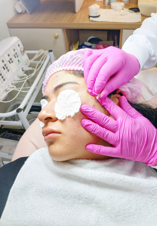 Tratamiento facial IPL – Terapia acné de 4 sesiones + limpieza facial