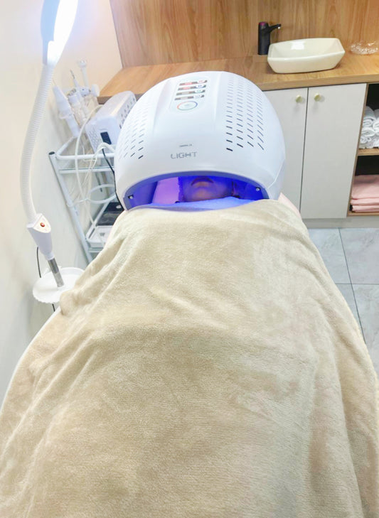 Tratamiento facial – Contrarrestar el acné activo