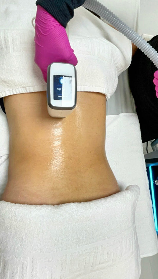 Depilación definitiva - láser DIODO / Espalda de 6 a 8 sesiones