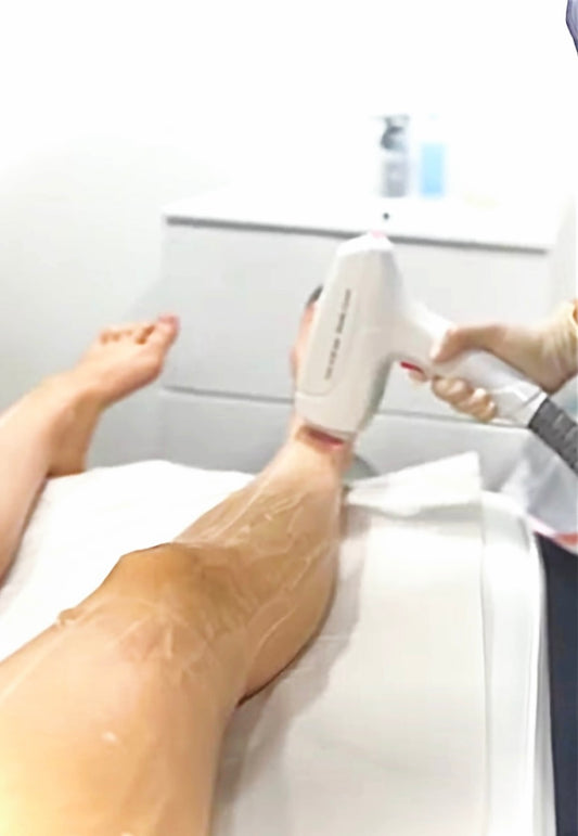 Depilación definitiva - láser DIODO / Media pierna de 6 a 8 sesiones