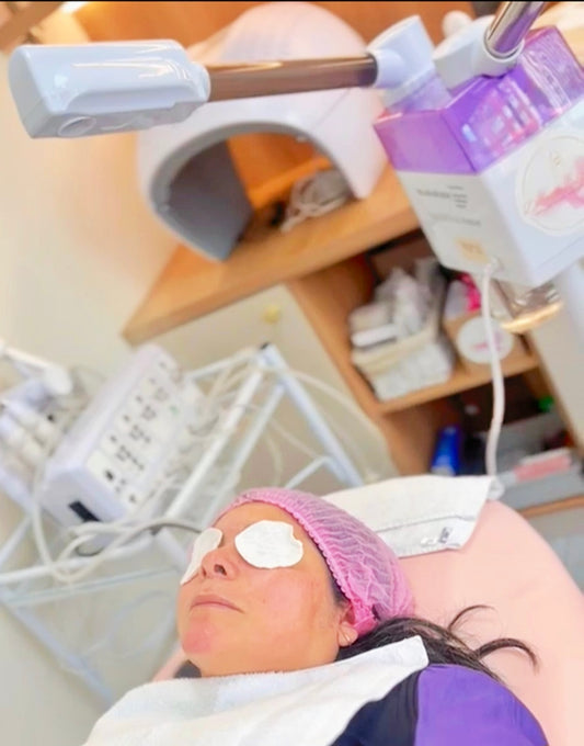 Tratamiento facial – Permeabilidad cutánea avanzada de 4 sesiones