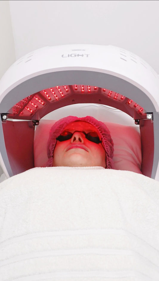 Tratamiento facial para eliminar secuelas de acné más hidratación profunda / 5 sesiones